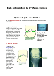 Ostéotomie tibiale de valgisation par addition interne