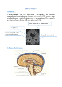 1- TDM cérébrale
