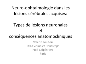 Types de lésions neuronales et conséquences
