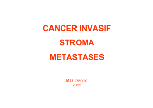cancer invasif stroma metastases