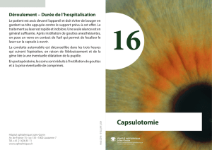 Capsulotomie - Fondation Asile des aveugles