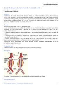 Cure endovasculaire d`un anévrisme de l`aorte abdominale