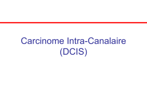 Carcinome Intra-Canalaire (DCIS)