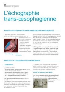L`échographie trans-œsophagienne - Centre Cardio