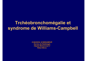 Trchéobronchomégalie et syndrome de Williams
