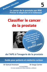 de l`APS à l`imagerie de la prostate