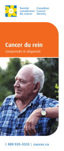 Cancer du rein : Comprendre le diagnostic