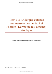 Item 114 : Allergies cutanéo- muqueuses chez l`enfant et l`adulte