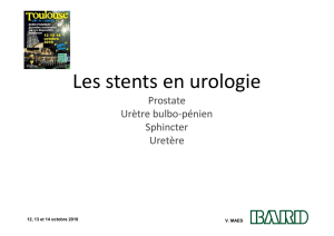 Les stents en urologie - Euro