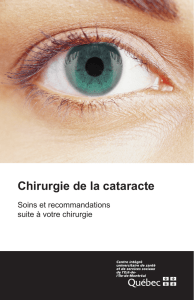 Chirurgie de la cataracte : soins postopératoires et