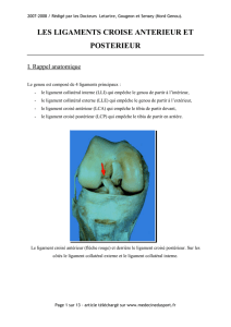 Genou : Lésion du ligament croisé antérieur et postérieur