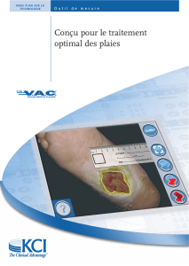 Info VAC - Feature Card Measurement Tool - Fr1.qxp
