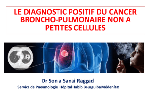 le diagnostic positif du cancer broncho