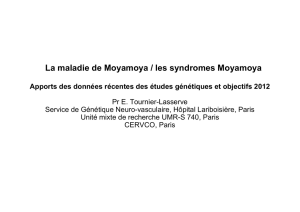 La maladie de Moyamoya / les syndromes Moyamoya