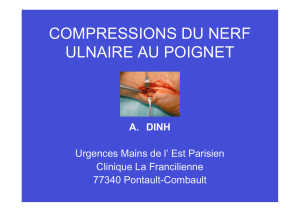 compressions du nerf ulnaire au poignet