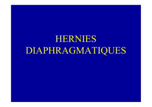 4 hernies diaphragmatiques