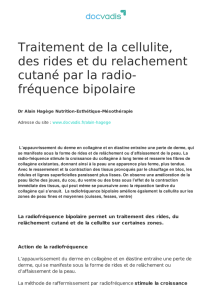 fréquence bipolaire