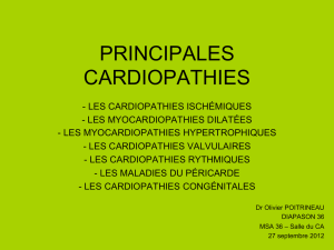 PRINCIPALES CARDIOPATHIES