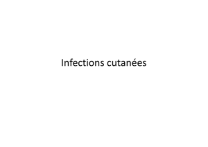 Infections cutanées