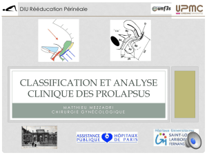 classification et analyse clinique des prolapsus - sifud-pp