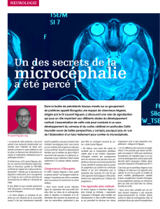 microcéphalie - GIGA - Université de Liège