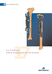 Le fixateur méta-diaphysaire XCaliber