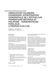 association colobome choroïdien, hypertrophie