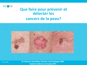 Que faire pour prévenir et détecter les cancers de la peau