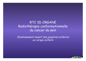 RTC 3D ORGANE Radiothérapie conformationnelle du