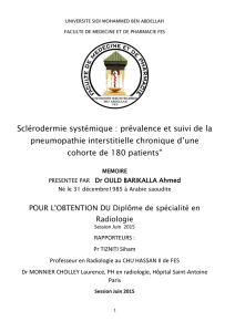 Sclérodermie systémique - Faculté de Médecine et de Pharmacie Fès