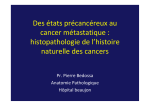 Des états précancéreux au cancer métastatique : histopathologie de
