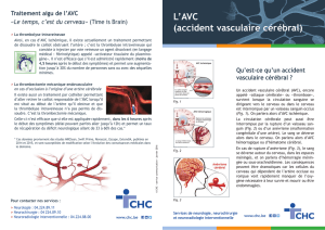L`AVC (accident vasculaire cérébral)