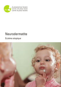 Neurodermatite - dermato