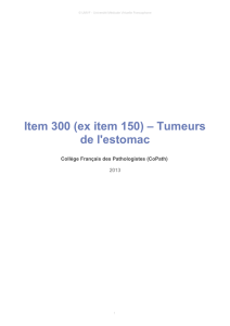 Item 300 (ex item 150) – Tumeurs de l`estomac