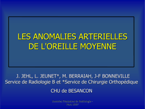 LES ANOMALIES ARTERIELLES DE L`OREILLE MOYENNE