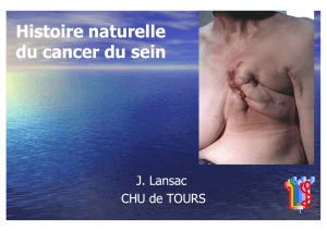 Histoire naturelle du cancer du sein