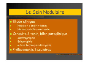Le Sein Nodulaire - Clinique Lyon-Nord