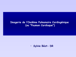 D C oedèmes pulmonaires cardiogéniques