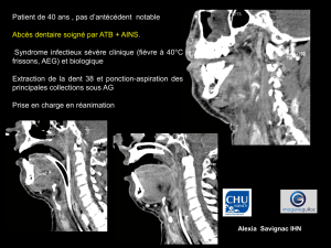 D CJ thorax cervico-médiastinite d`origine dentaire
