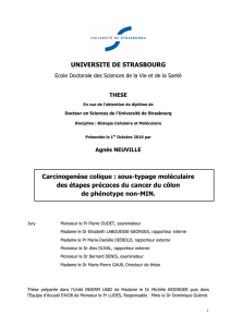 Carcinogenèse colique - Université De Strasbourg
