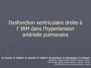 Dysfonction ventriculaire droite à l` IRM dans l`hypertension artérielle
