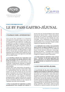 Fiche information by pass gastro-jéjunal ( PDF )