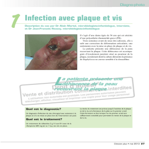 1 Infection avec plaque et vis - STA HealthCare Communications