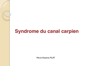 Syndrome du canal carpien - Marie