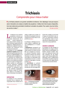 Trichiasis - Pratiques en Ophtalmologie