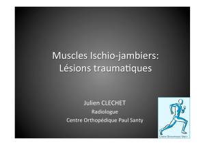 Muscles Ischio-‐jambiers: Lésions trauma ques