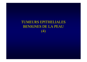 Tumeurs epitheliales benignes cutanees (4).