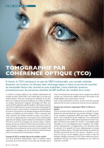 TOMOGRAPHIE PAR COHÉRENCE OPTIQUE (TCO)