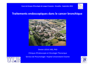 Traitements endoscopiques dans le cancer bronchique