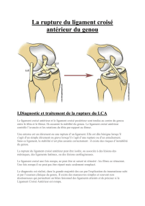 La rupture du ligament croisé antérieur du genou